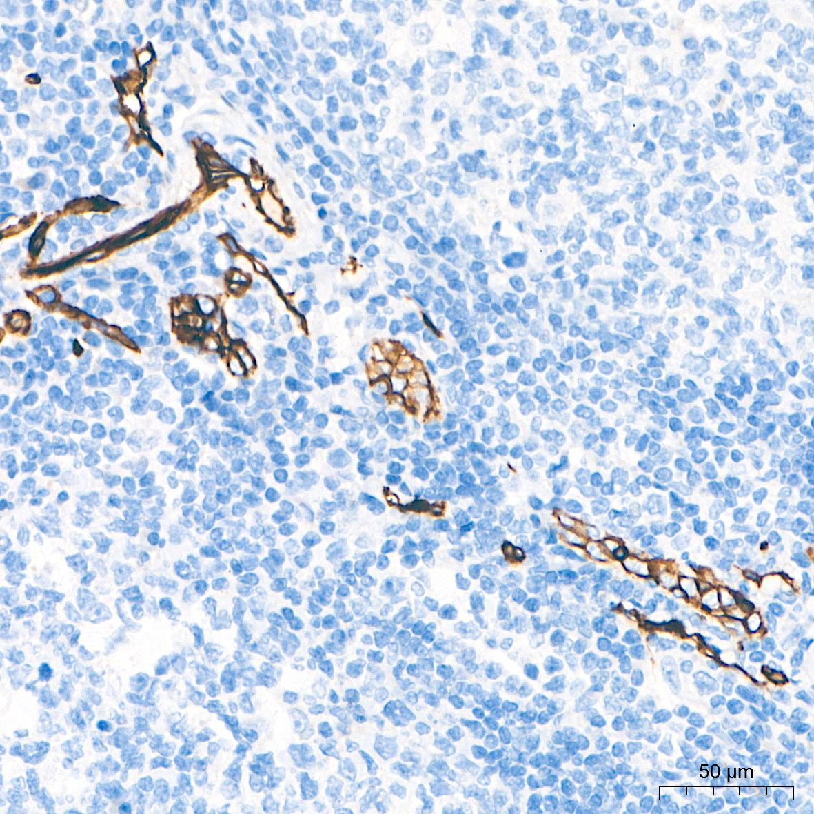 CD34 Rabbit mAb