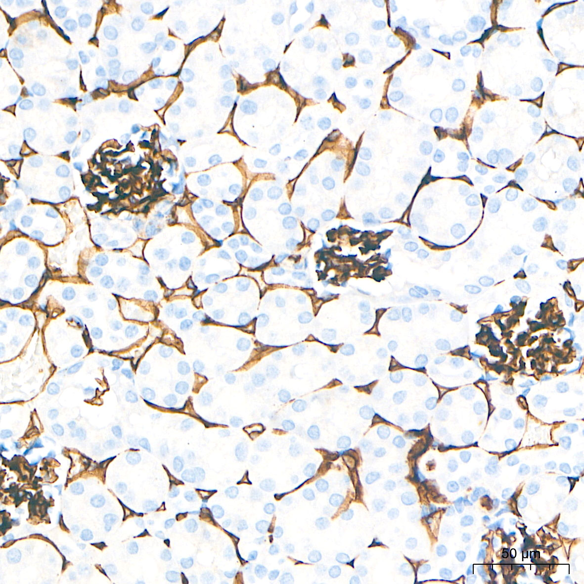 CD34 Rabbit mAb