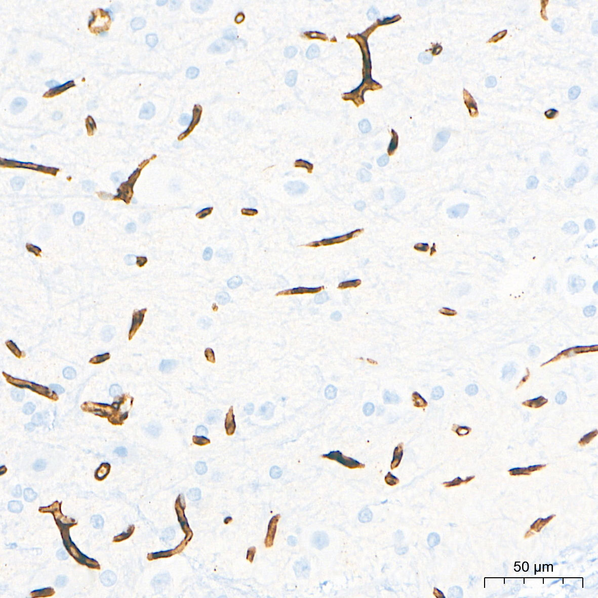 CD34 Rabbit mAb