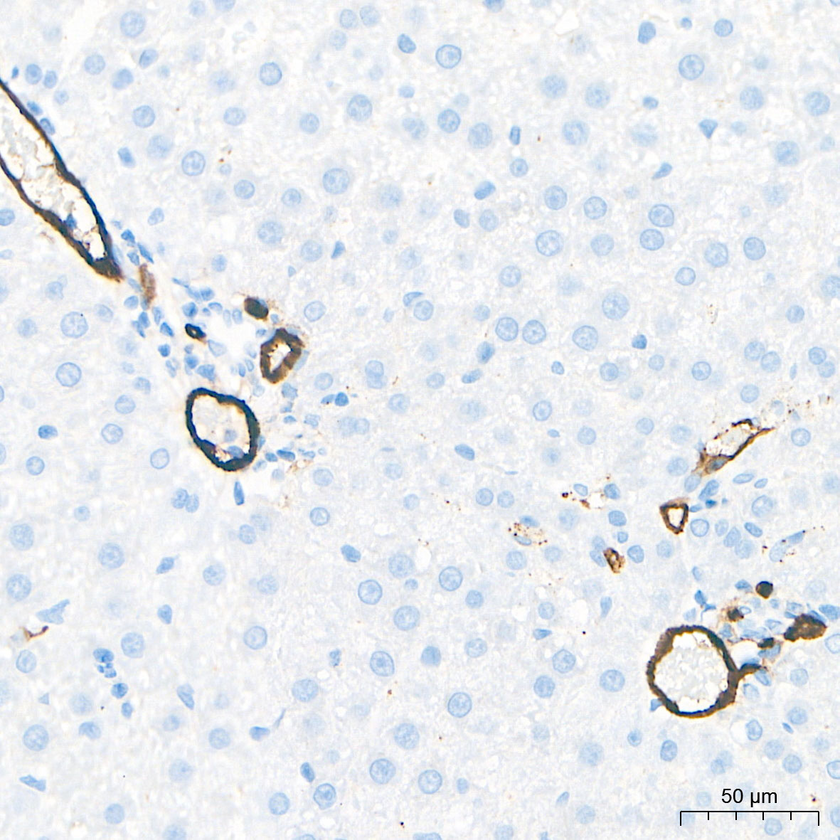 CD34 Rabbit mAb