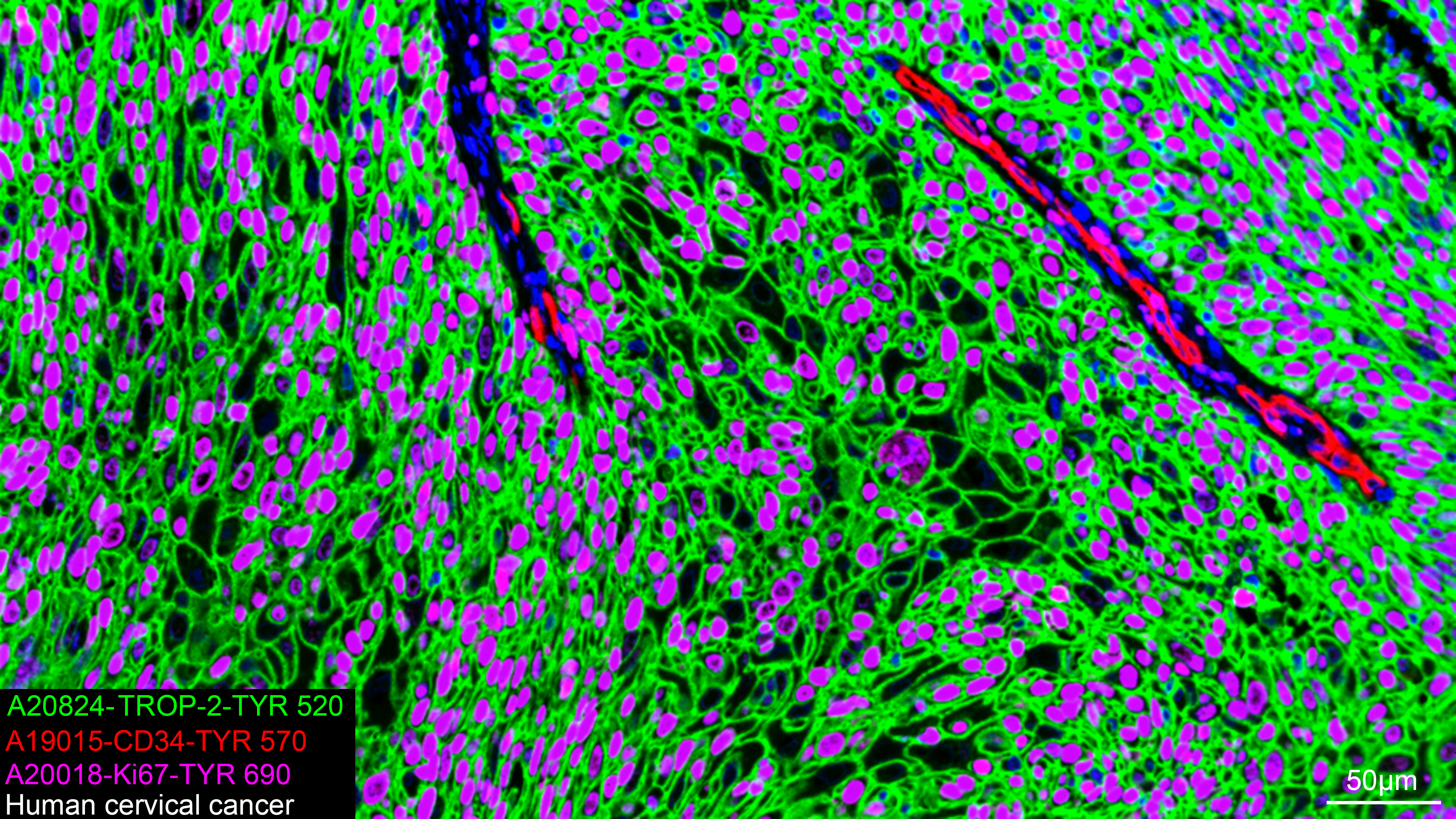 CD34 Rabbit mAb