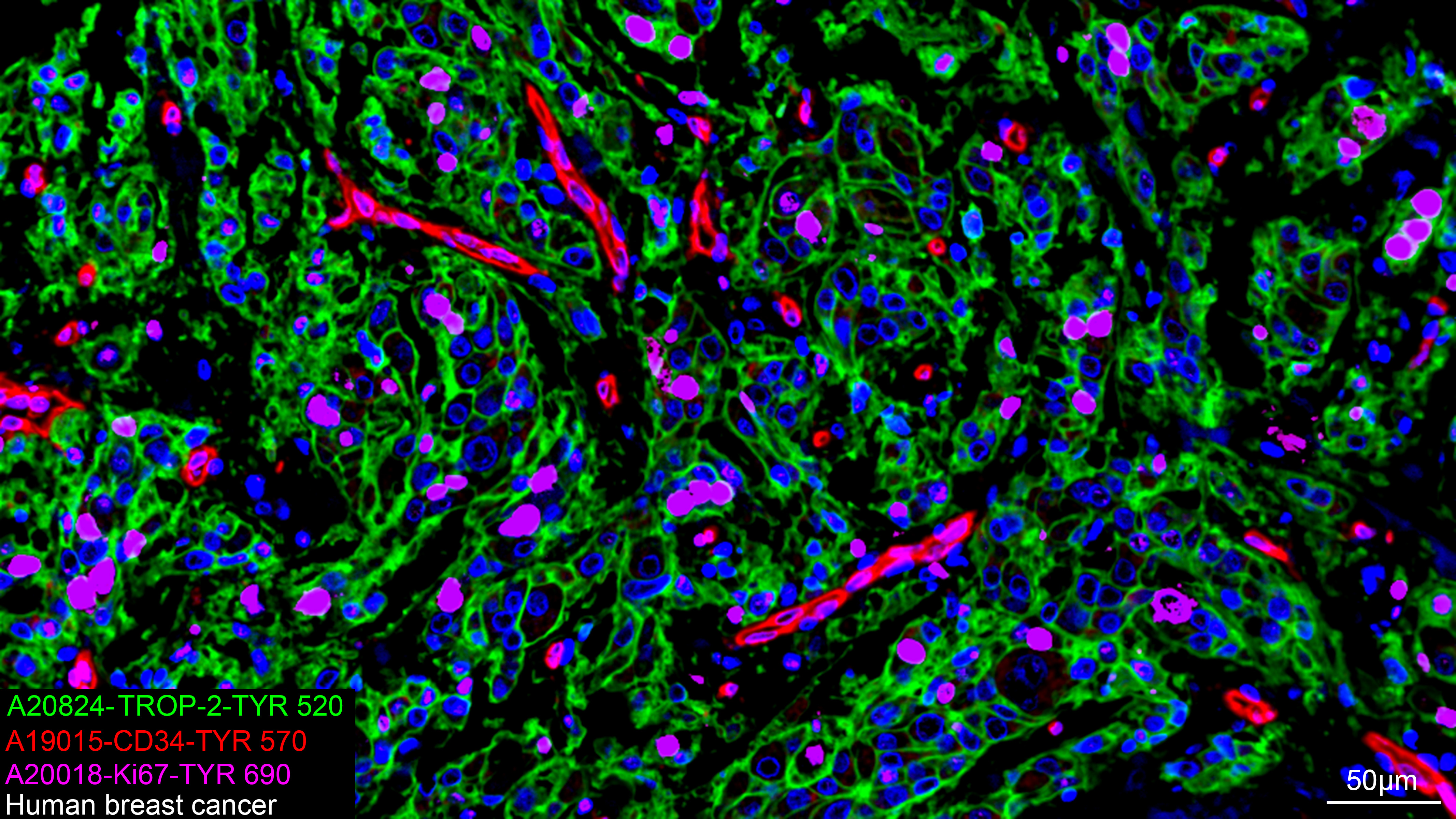 CD34 Rabbit mAb