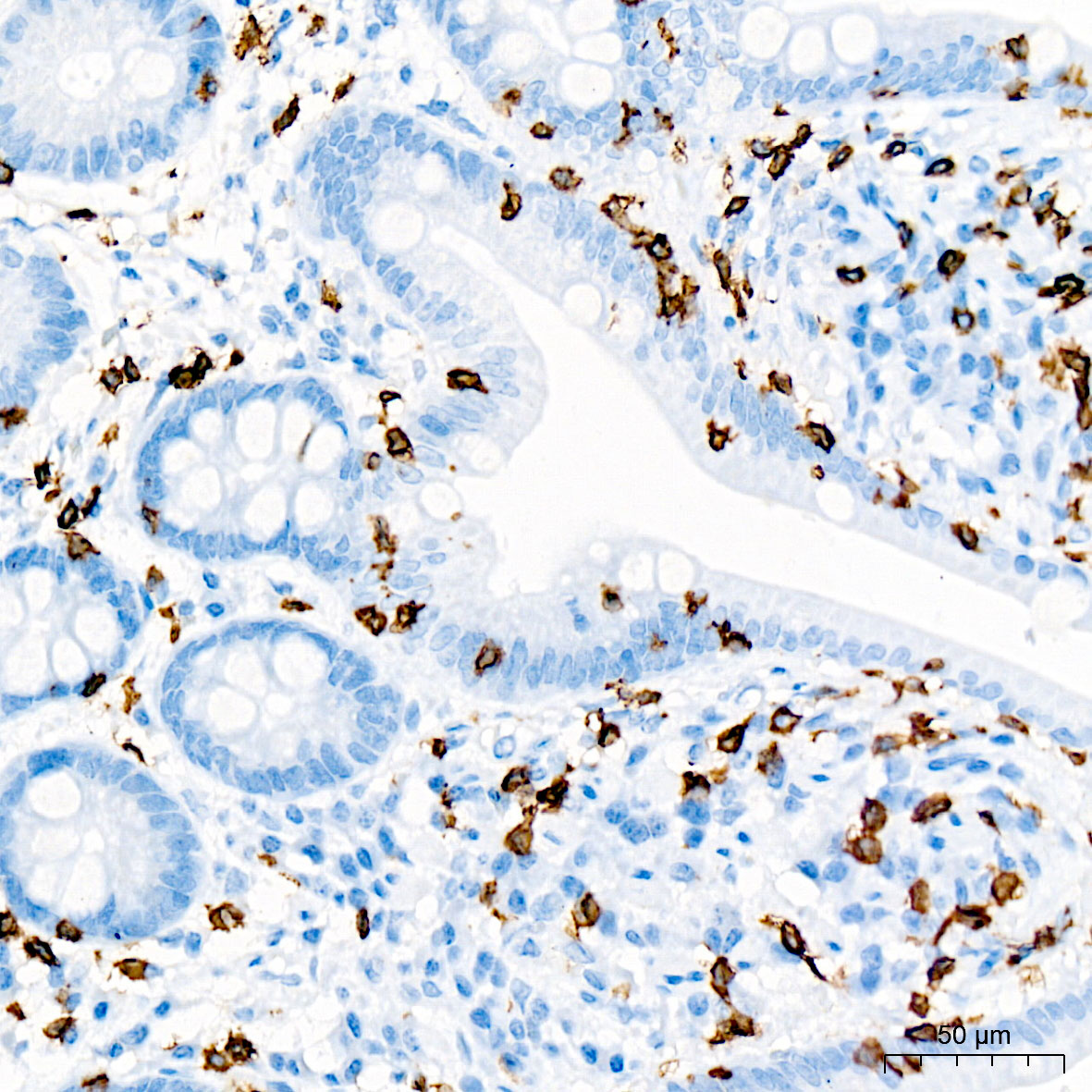 CD3点 CD3E Rabbit mAb