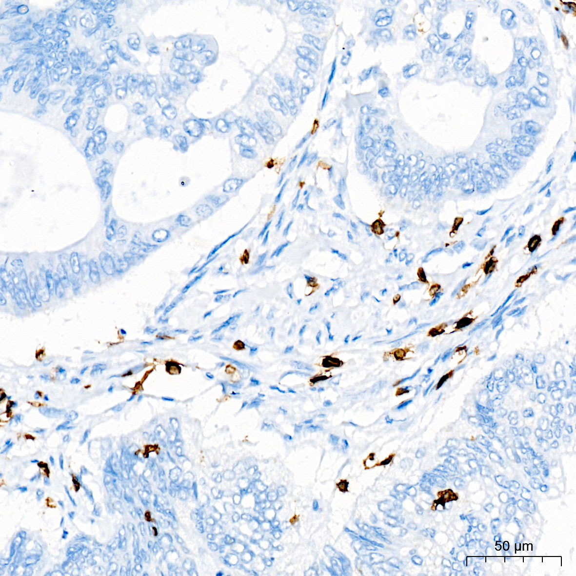 CD3点 CD3E Rabbit mAb