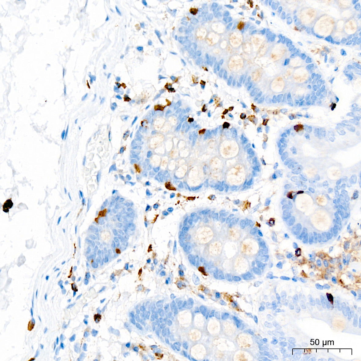 CD63 Rabbit mAb