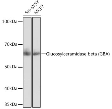 Glucosylceramidase beta (GBA) Rabbit mAb