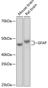 GFAP Rabbit mAb GFAP Rabbit mAb