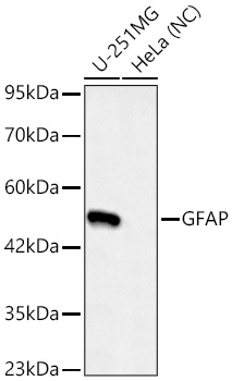 GFAP Rabbit mAb GFAP Rabbit mAb