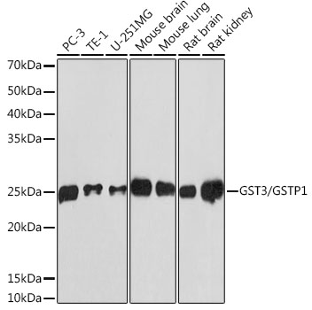 GST3/GSTP1 Rabbit mAb