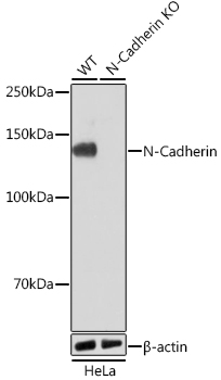 [KO Validated] N-Cadherin Rabbit mAb