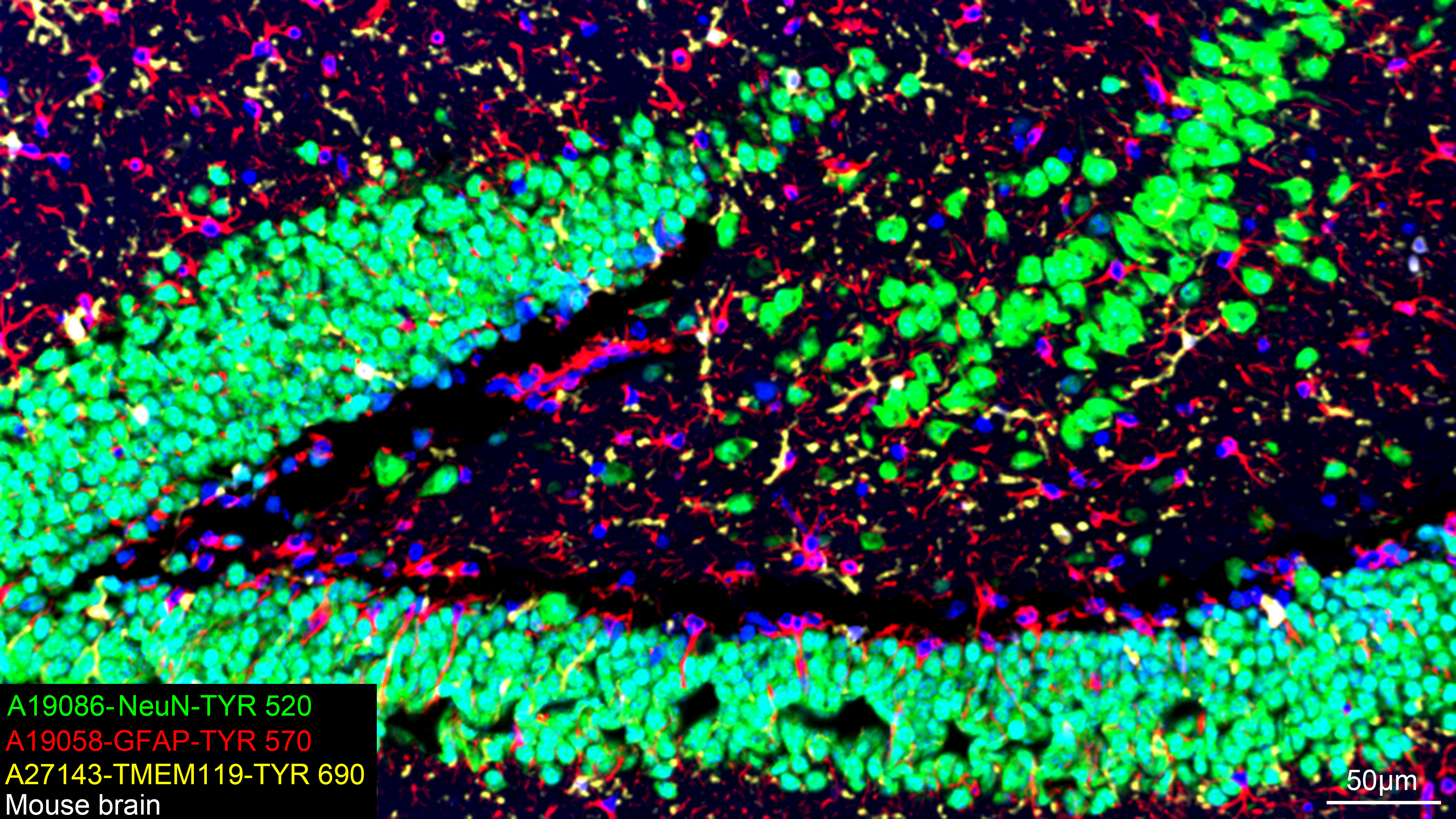 NeuN Rabbit mAb