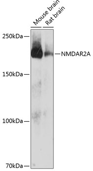 NMDAR2A Rabbit mAb