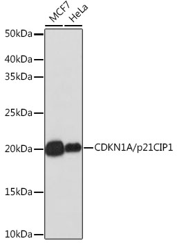 [KO Validated] CDKN1A/p21 Rabbit mAb