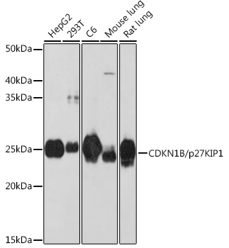 CDKN1B/p27KIP1 Rabbit mAb