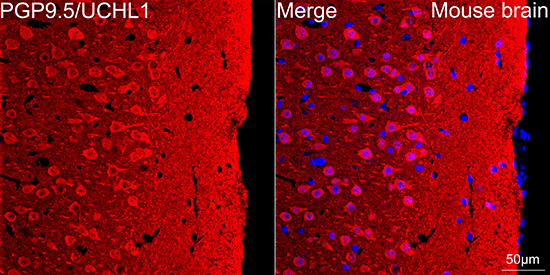 ma5ページ IL11RA Rabbit mAb