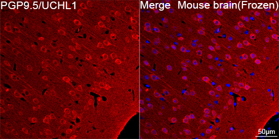 ma5ページ PGP9.5/UCHL1 Rabbit mAb