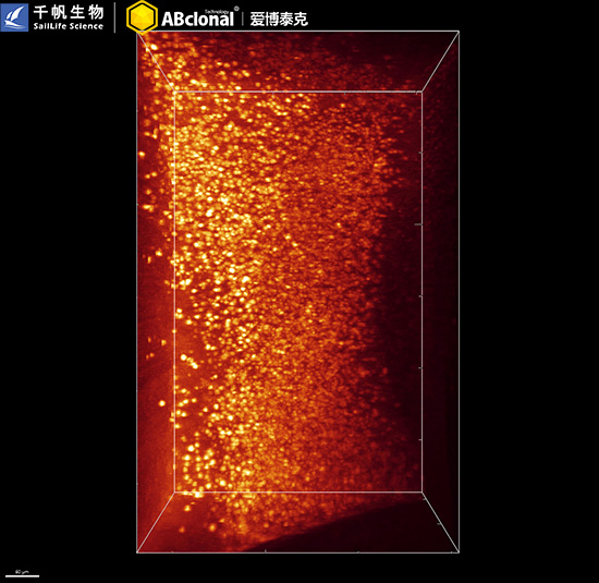 PGP9.5/UCHL1 Rabbit mAb