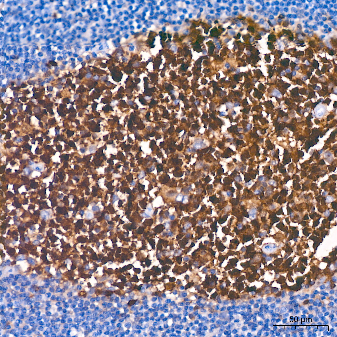 ma5ページ IL11RA Rabbit mAb
