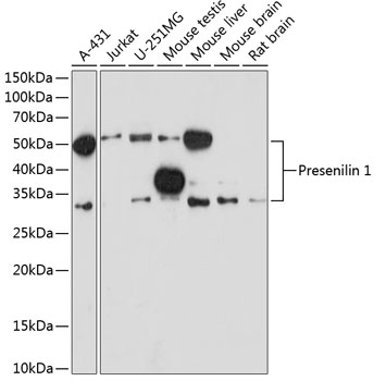 Presenilin 1 Rabbit mAb