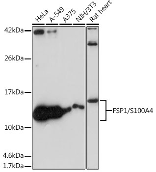 FSP1/S100A4 Rabbit mAb