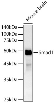 [KO Validated] Smad1 Rabbit mAb