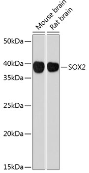 SOX2 Rabbit mAb