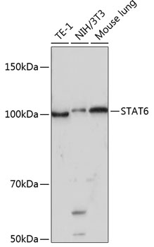 STAT6 Rabbit mAb