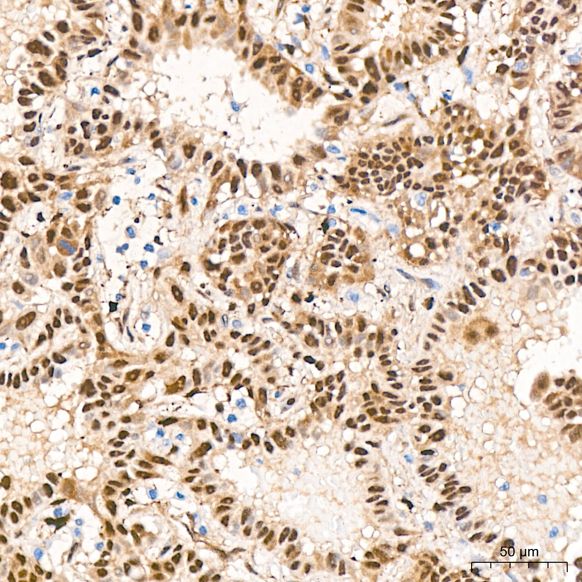KO Validated] YAP1 Rabbit mAb