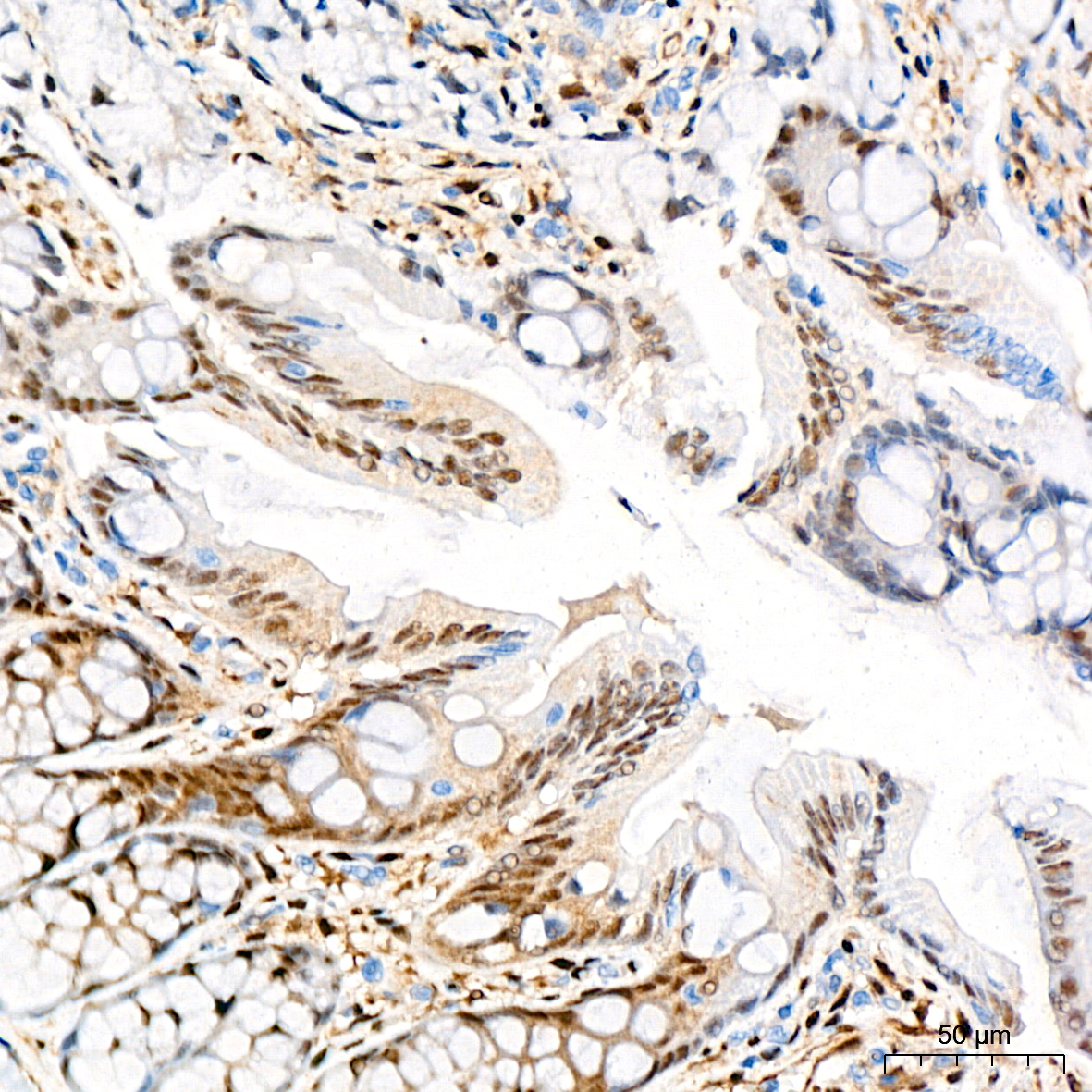 Chris様ページ YAP Antibody (H-9) | SCBT - Santa Cruz Biotechnology