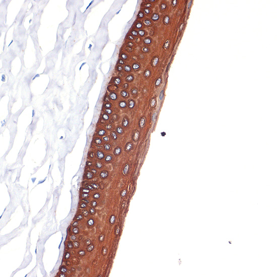 Cytokeratin 12 (KRT12) Rabbit mAb