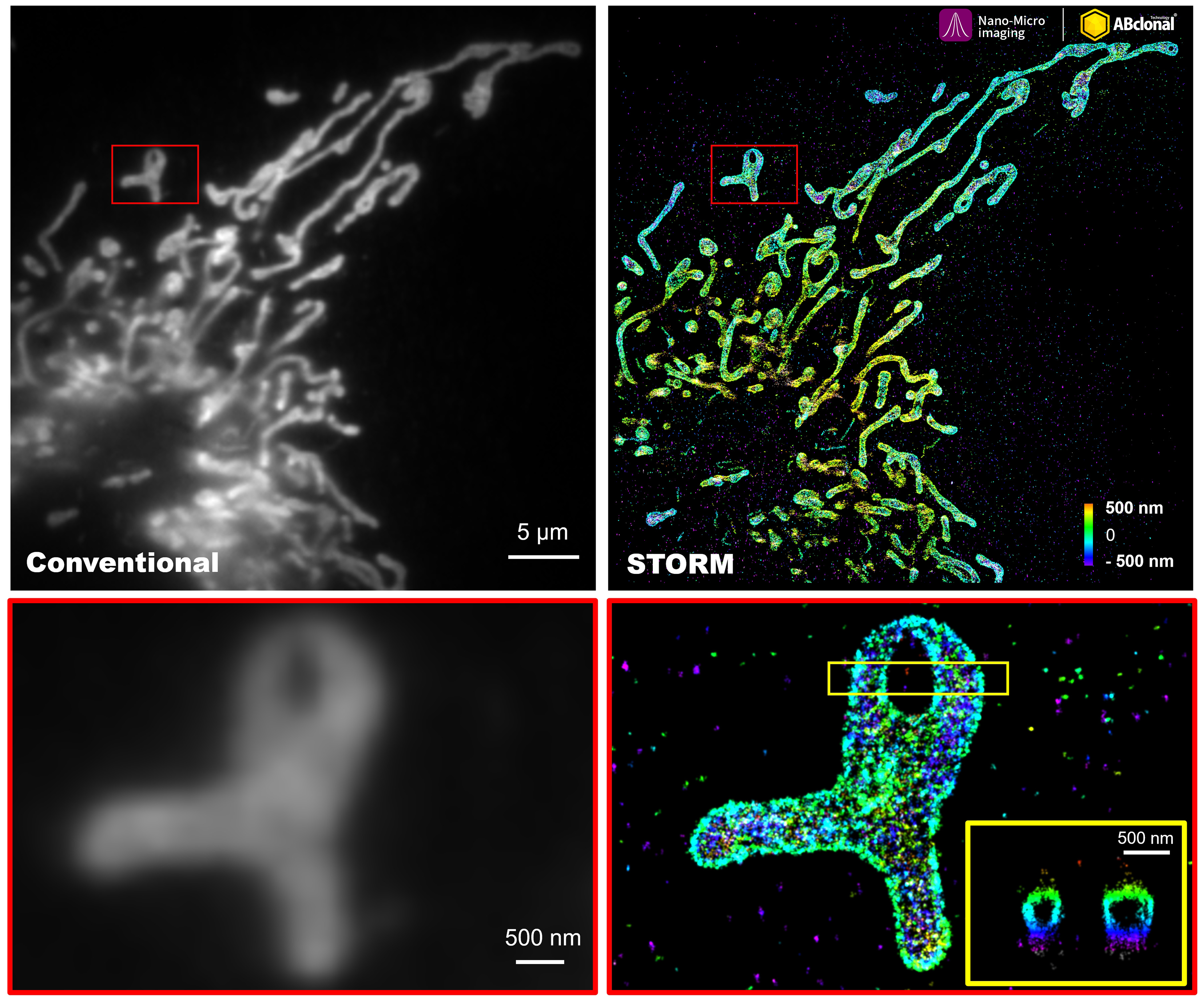 TOM20 Rabbit mAb