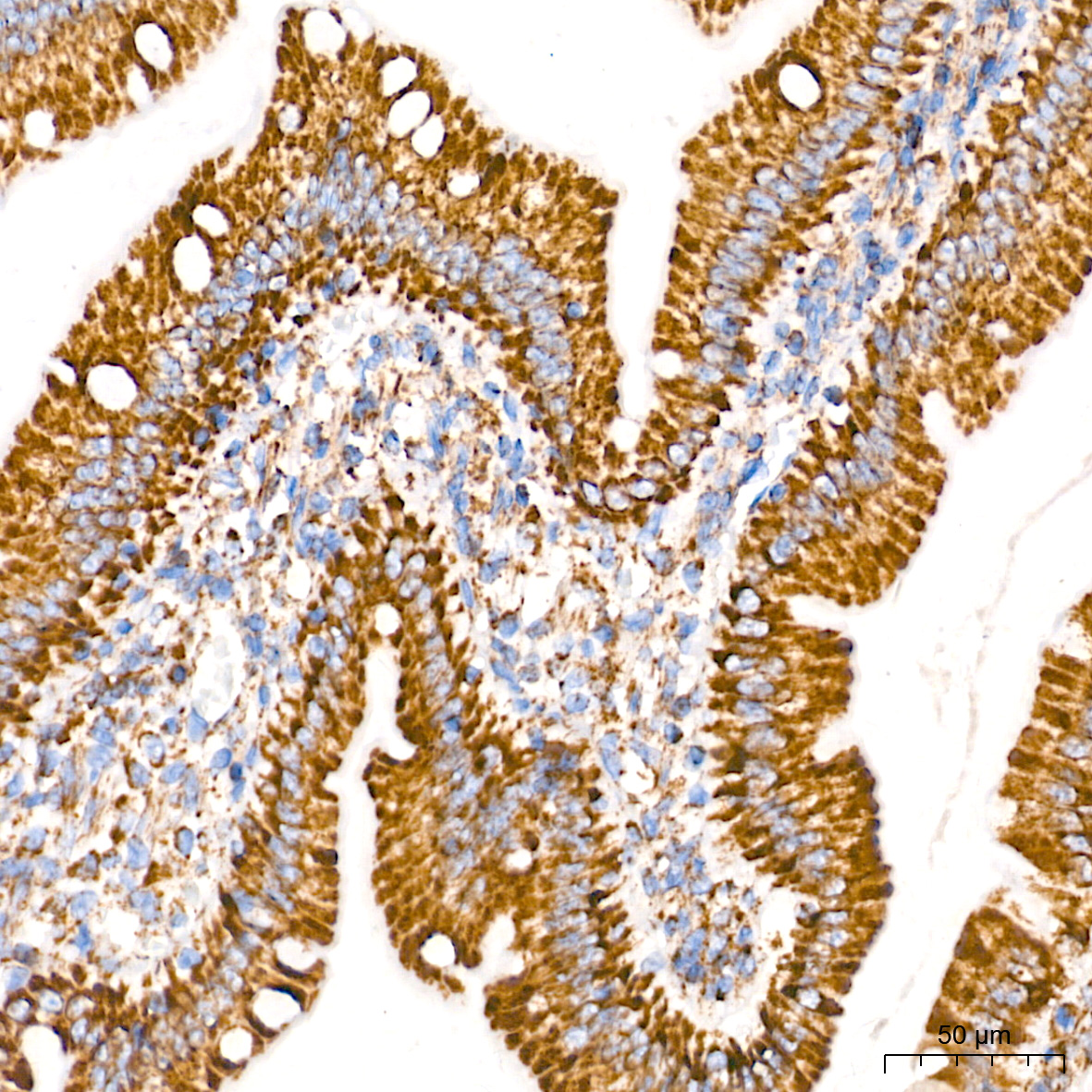 TOM20 Rabbit mAb