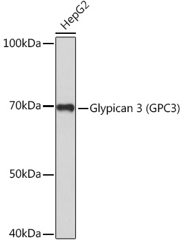 Glypican 3 (GPC3) Rabbit pAb