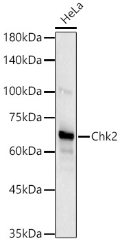 Chk2 Rabbit mAb