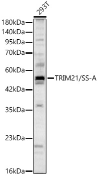 [KD Validated] TRIM21/SS-A Rabbit pAb