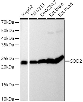 [KO Validated] SOD2 Rabbit mAb