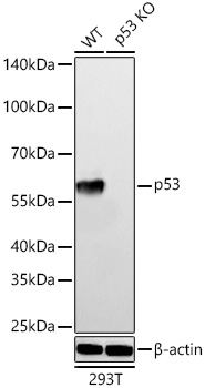 [KO Validated] p53 Rabbit mAb