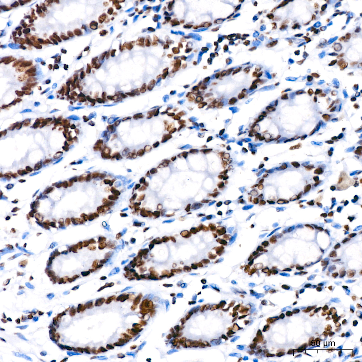 PARP1 Rabbit mAb