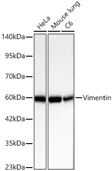 [KD Validated] Vimentin Rabbit mAb