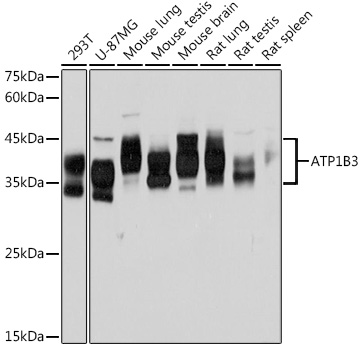 ATP1B3 Rabbit mAb