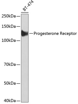 Progesterone Receptor Rabbit mAb