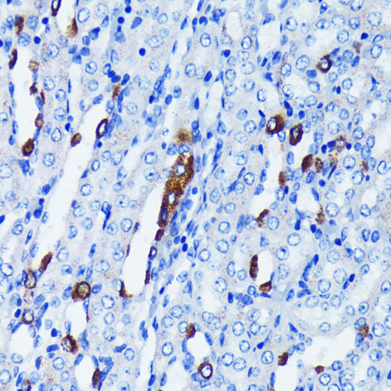 IκBα Rabbit mAb
