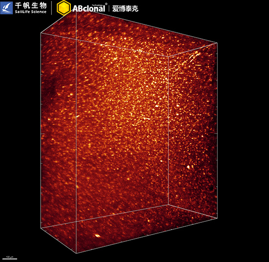 あおきち AIF1/IBA1 Rabbit mAb