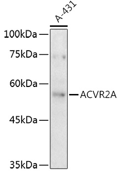 ACVR2A Rabbit pAb