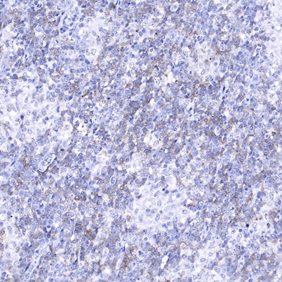 PD-1/CD279 Mouse mAb