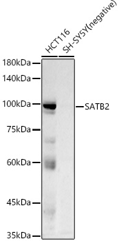 SATB2 Rabbit mAb