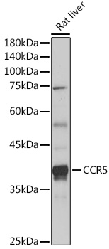 CCR5 Rabbit pAb