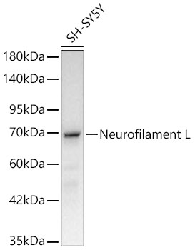 Neurofilament L Rabbit mAb