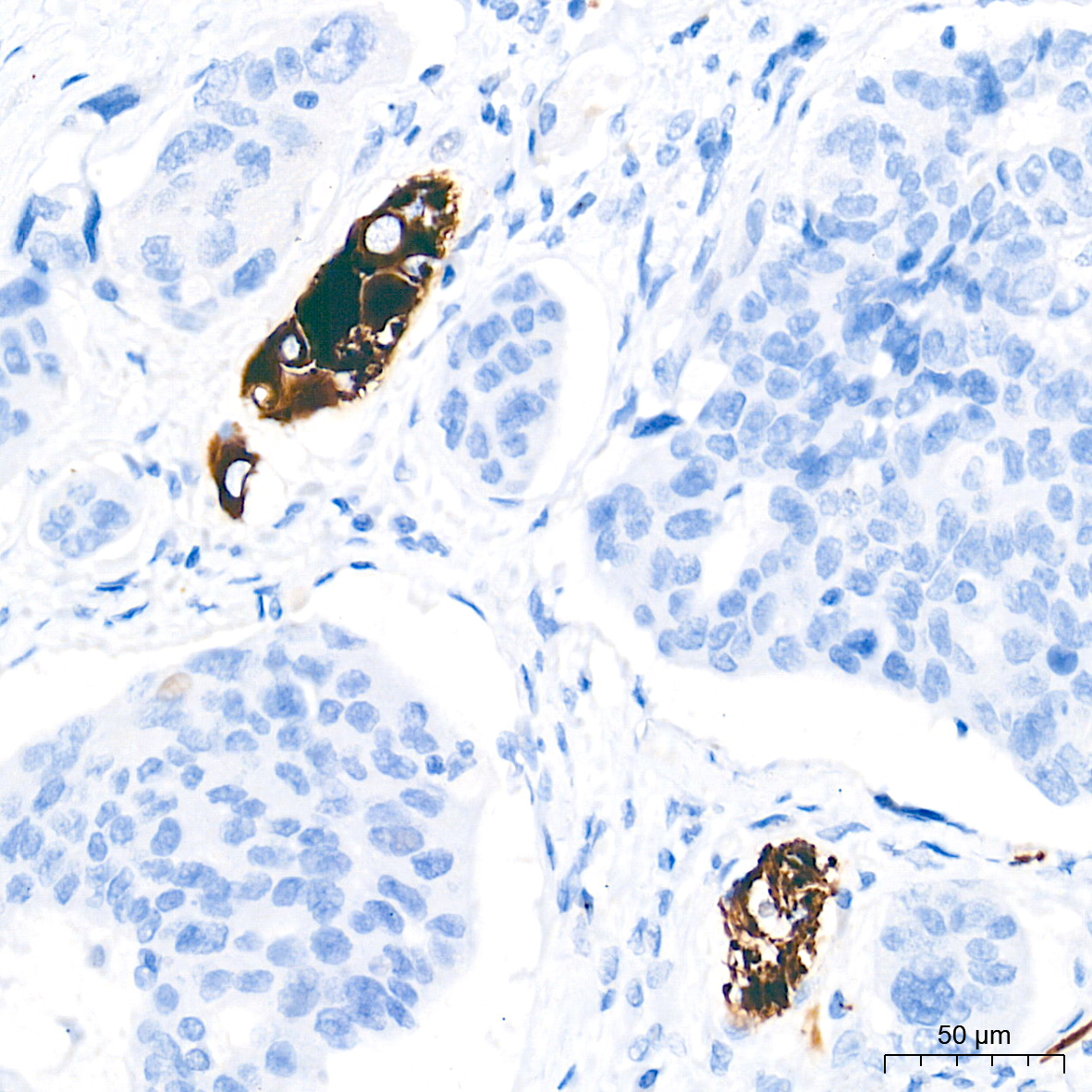 Neurofilament L Rabbit mAb