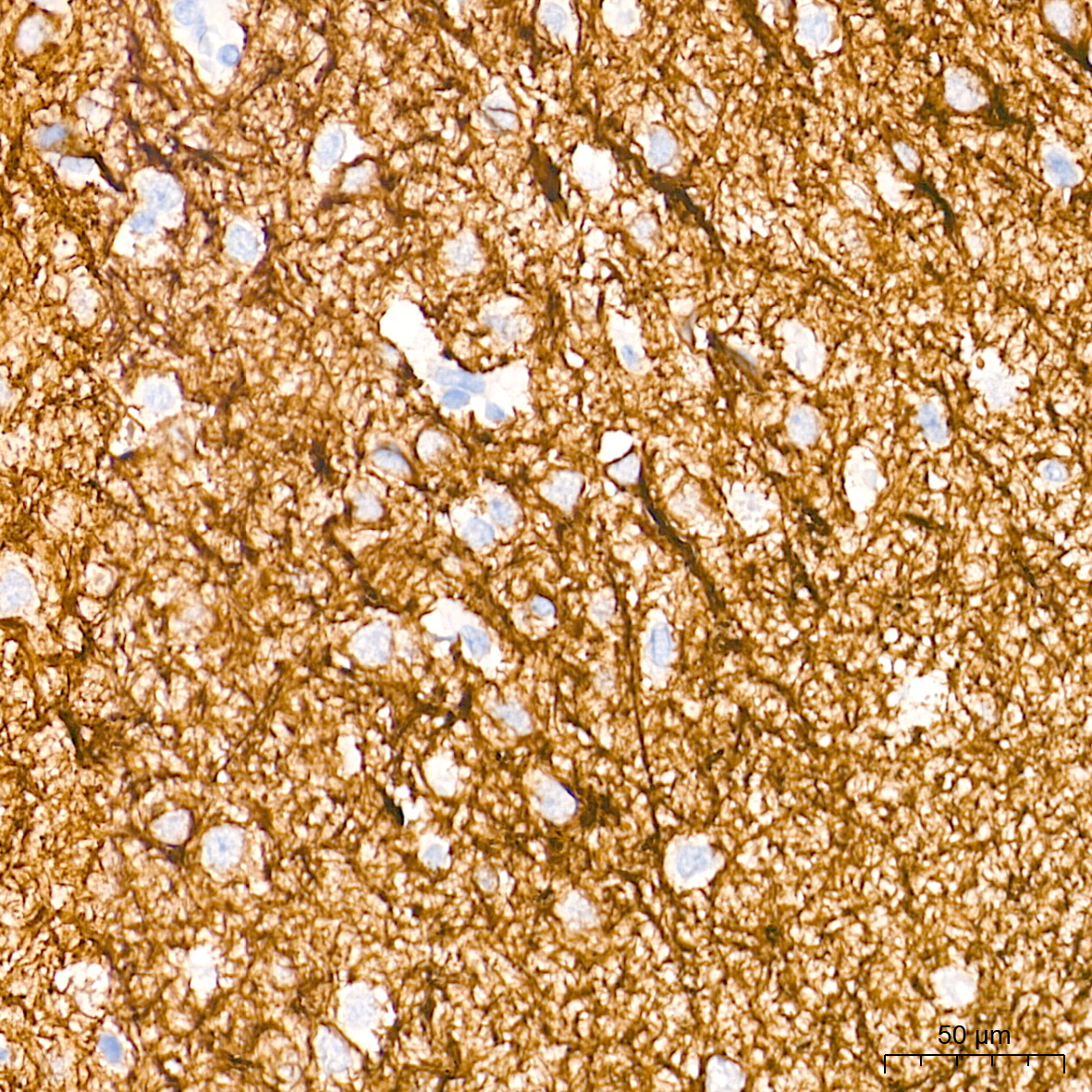 Neurofilament L Rabbit mAb